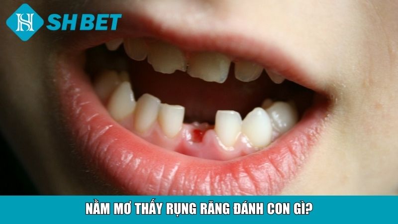 Nằm mơ thấy rụng răng đánh con gì?